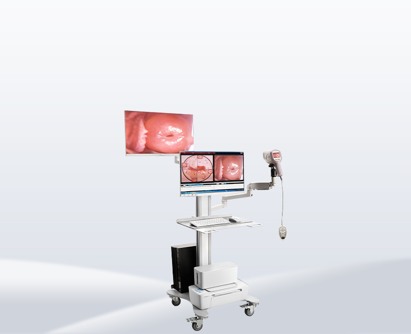 KN-2200I（H）Video Colposcope